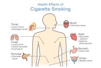 What Are The Long-Term Effects Of Smoking On Health