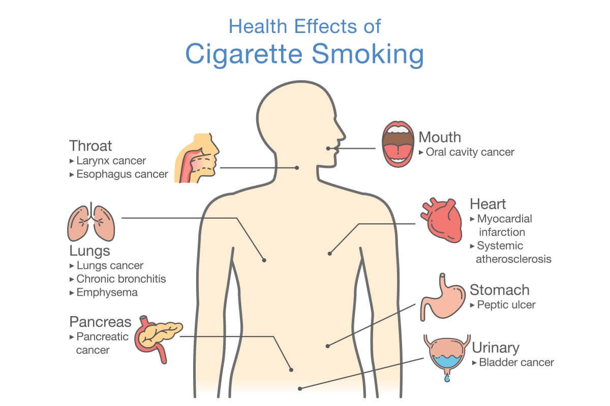 What Are The Long-Term Effects Of Smoking On Health