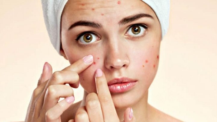 Perawatan Kulit Yang Tepat Untuk Penampilan Maksimal