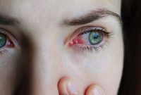 Apa Saja Tanda-Tanda Tubuh Kekurangan Vitamin