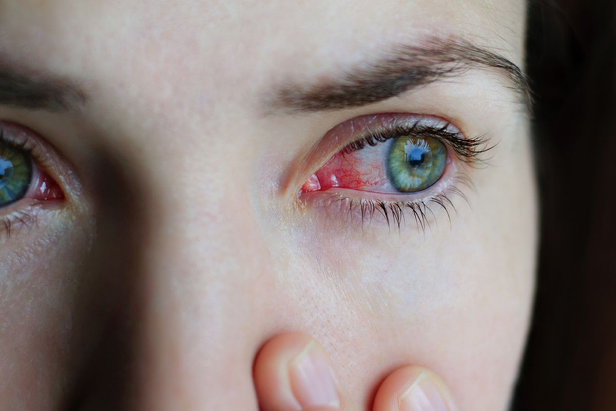 Apa Saja Tanda-Tanda Tubuh Kekurangan Vitamin